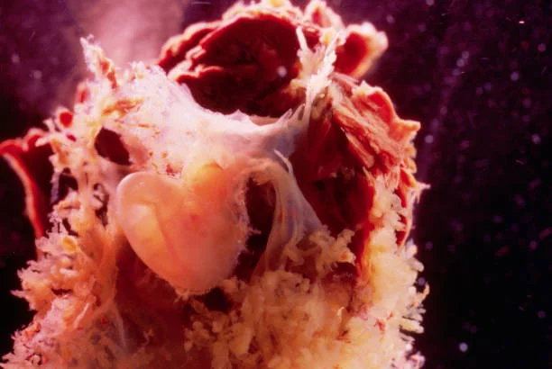 Contractions placentaires : un signal dynamique à mieux distinguer des contractions utérines