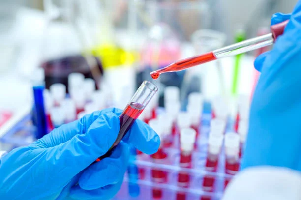 Alzheimer : un simple biomarqueur sanguin peut-il prédire le déclin cognitif ?