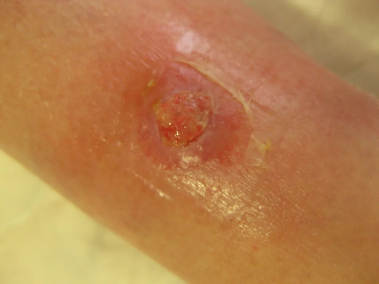 Wat is uw diagnose?