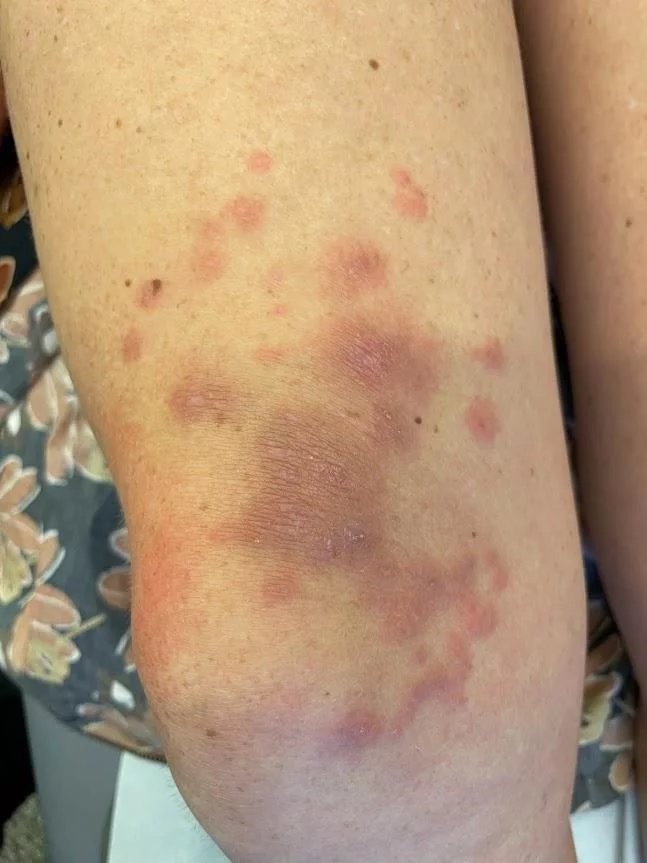 Wat is uw diagnose?