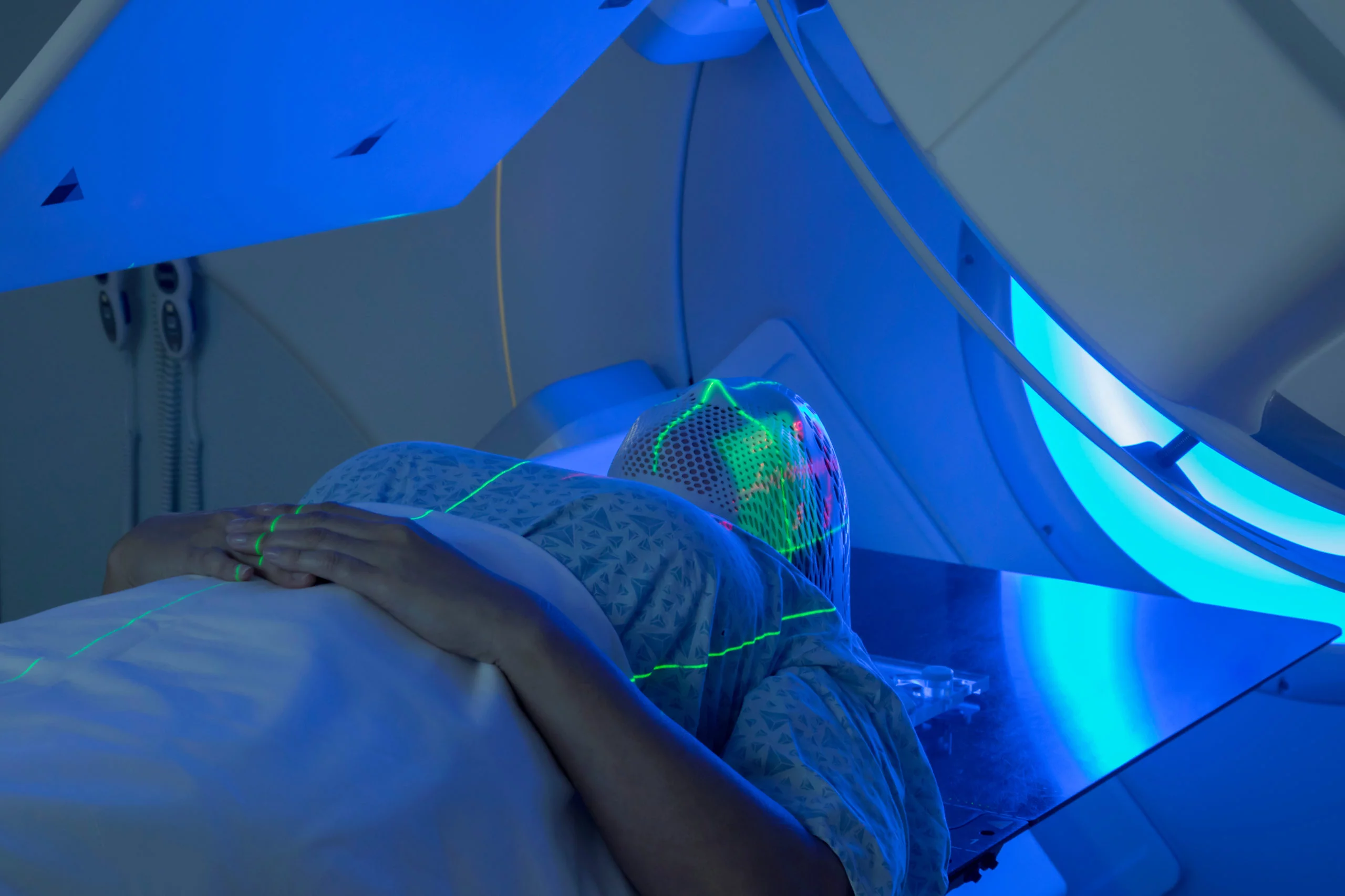Aanpassing van radiotherapie tegen hersenkanker: een persoonlijke zoektocht