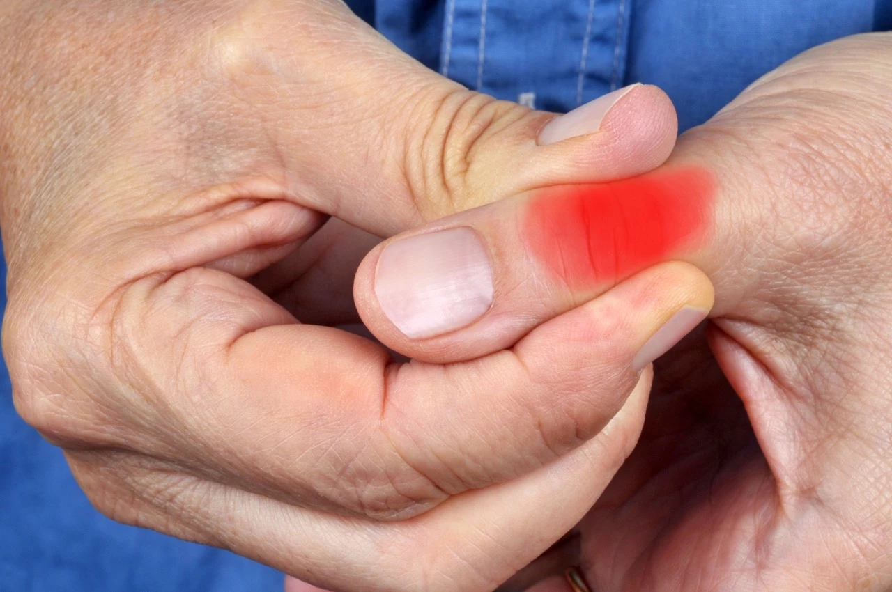 Une plateforme pour mieux comprendre la rhizarthrose