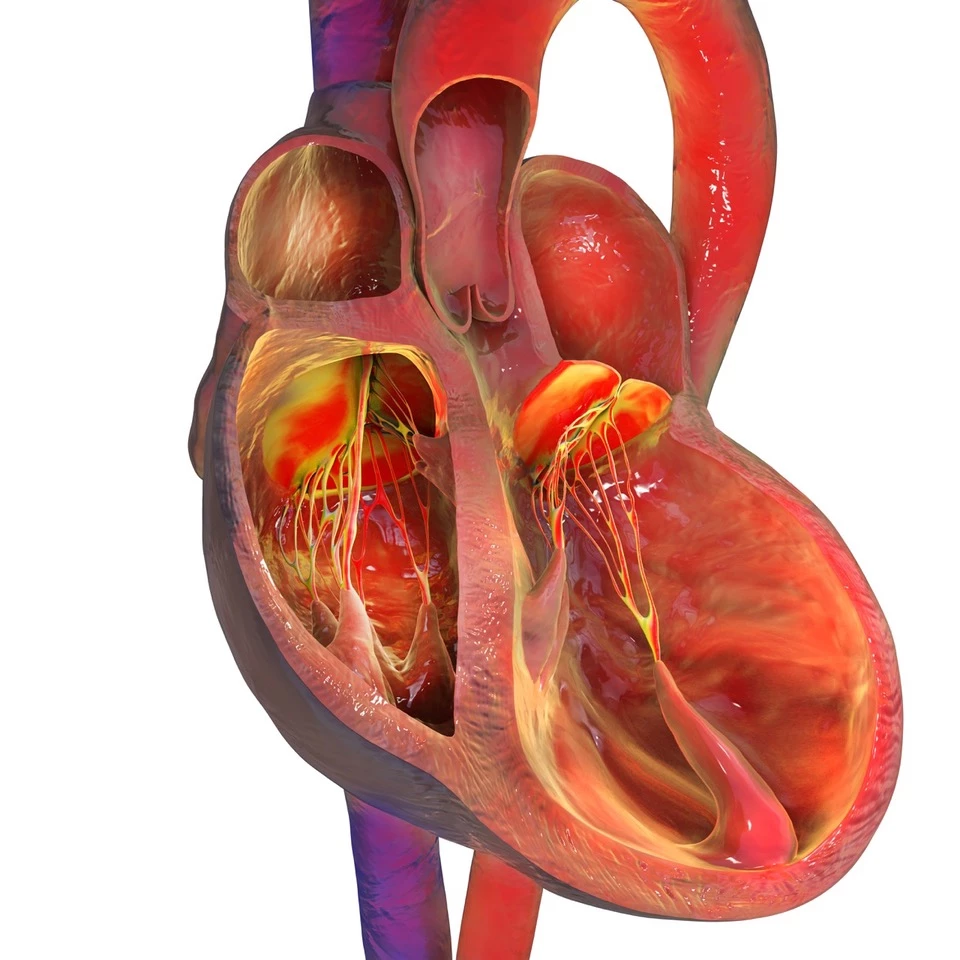 HFrEF: een hoog residueel risico ondanks een optimale viervoudige combinatietherapie