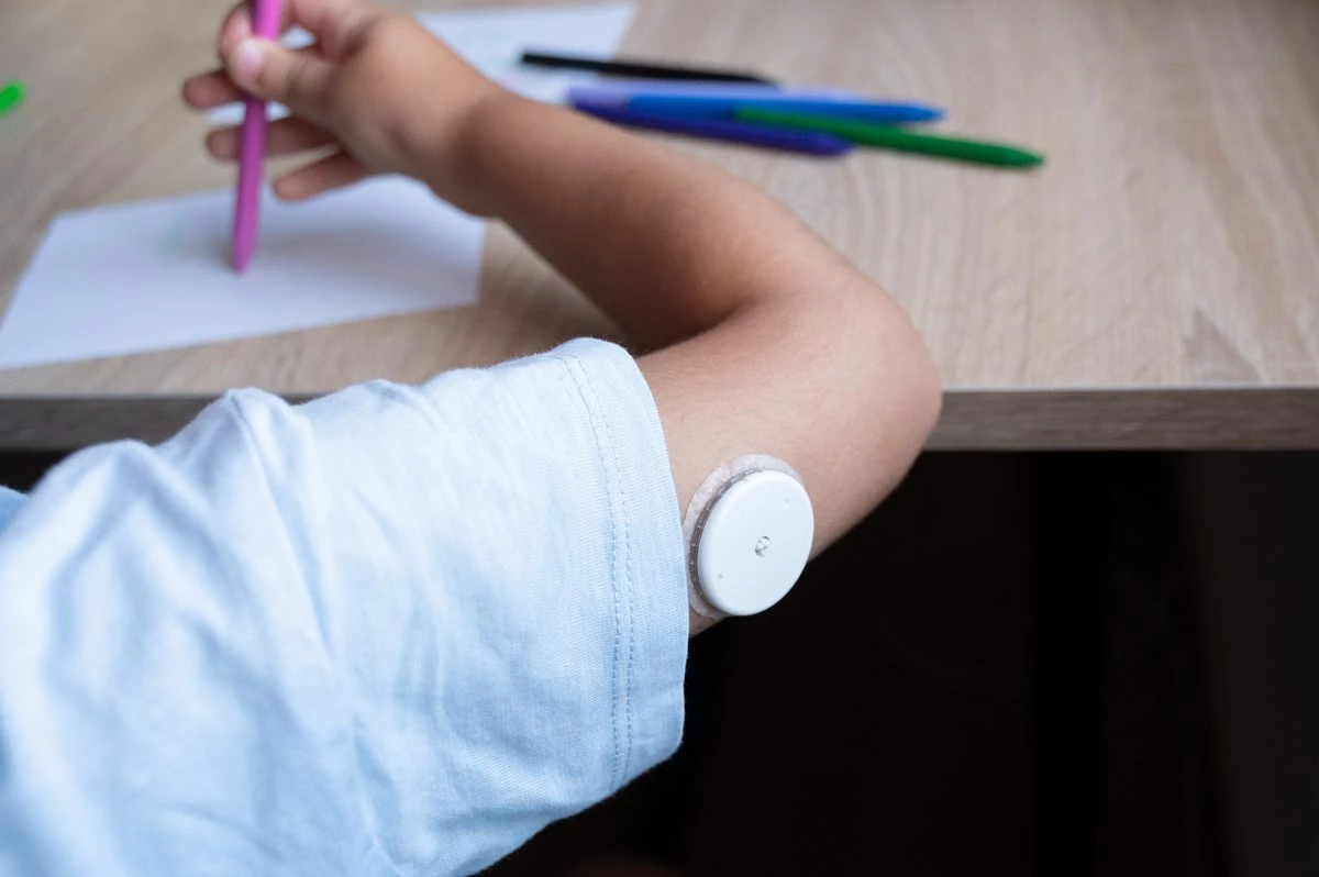 Diabète de type 1 dès l’enfance : l’âge au diagnostic influence-t-il les complications à l’âge adulte ?